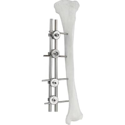 China Orthopedic Implant Femur Tibial External Fixator Bone Surgery Fixator for sale