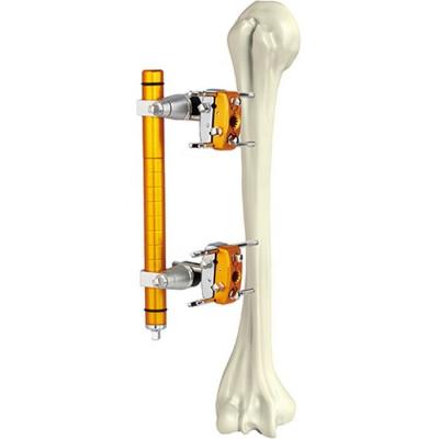 China Medical Orthopedic Surgical Instruments Humeral Shaft External Fixator for sale