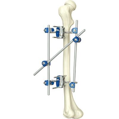 China Excellent Quality Instrument Orthopedic Tibia & Percone External Fixator Orthopedic Surgical Instruments for sale