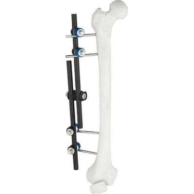 China Hot Sale Orthopedic Surgical Instruments Tibial & Femur External Fixator AO External Fixation Orthopedic Instrument for sale