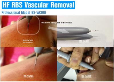 China Professional Vascular Removal Machine , Spider Vein Removal Machine High Frequency for sale
