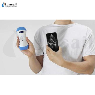 China Linear Convex Phased Array 3 In 1 Handheld Pocket Ultrasound Scanner With APP à venda
