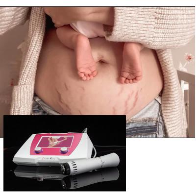 China Tratamiento de la celulitis Dispositivo de terapia con ondas de choque acústica Máquina de masaje de la celulitis con ondas de choque en venta