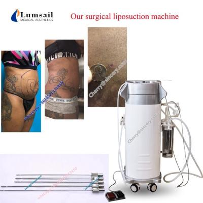 China Liposuction quirúrgico del vacío de la cavitación de la pérdida de peso de la máquina del Liposuction del retiro gordo en venta