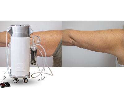 China Power Assisted Surgical Vacuum Liposuction Cavitation Machine For Thighs / Arms / Back Treatment for sale