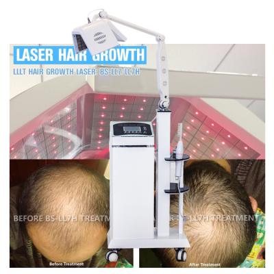 China De de Lasertherapie van de haartherapie LLLT kweekt Haar met de Echte Machine van de het Haarhernieuwde groei van de Diodenlaser Te koop