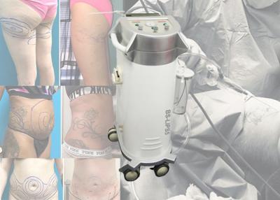 China Põe a lipoaspiração ajudada do laser da máquina da lipoaspiração para remover a gordura do corpo à venda