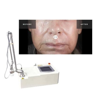 China Portable 15w Co2 Fractional  Acne Surgical Scar Laser Machine for sale