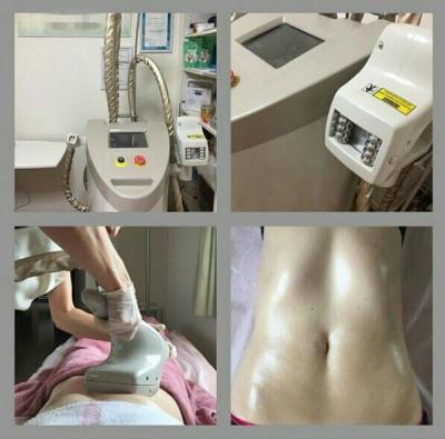 China 10M Hz RF Frequency Vacuum Slimming Machine With 50mm X 55mmBody Handpiece Treatment Area for sale