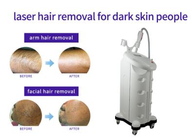 China Solid State Laser Hair And Tattoo Removal Machine , Industrial Laser Hair Removal Machine for sale
