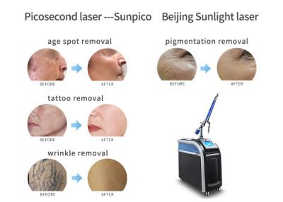 Китай Кожа забеливая деятельность машины удаления татуировки лазера пикосекунды легкую продается