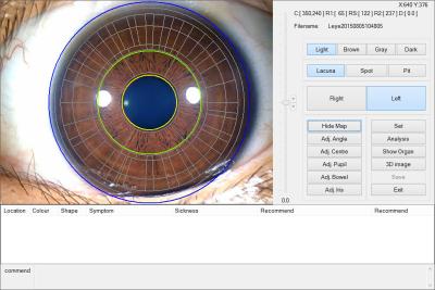Chine approbation de la machine d'essai d'oeil de caméra de 12.0MP Digital Iriscope Iridology CE/DHL à vendre