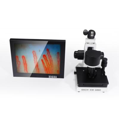 China Portable 10 Inch LED Display Nail Fold Capillaroscopy Microcirculation Test Machine for sale