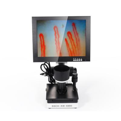 China LCD Digital Biological Microscope Microcirculation Checking Capillary Microscope for sale