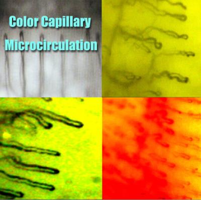 China Hospital Nailfold Capillary Microscopy /  Microcirculation Microscope Multi Function for Medical for sale