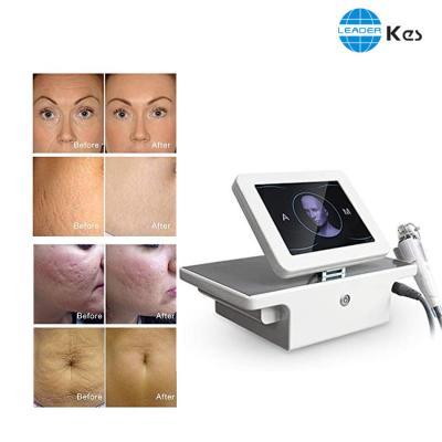 China Skin Tightening ISO13485 2MHz - 4MHz Microneedle Rf Machine for sale