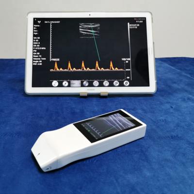 China Wireless Ultrasound Tranducer Android Color Doppler Ultrasound Probe Wireless Charging for sale