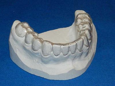 China dental night guard for sale