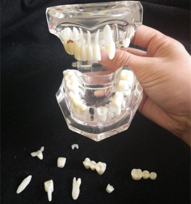 China Os dentes patológicos da atividade removível dos materiais dentais modelam à venda