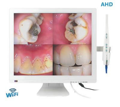 China Wireless Wifi Dental Digital Mouthwatch Intraoral Camera 17 Inch LED Monitor for sale