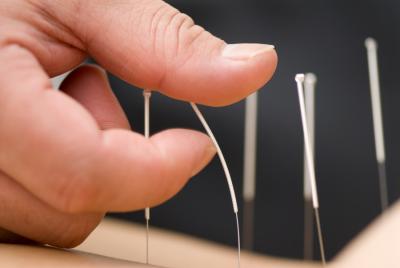 China sterile Nadeln der Wegwerfakupunktur-100pcs/Box für chinesische medizinische Akupunktur zu verkaufen