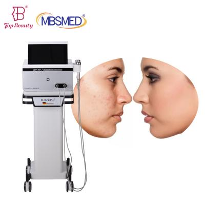 China Ldm Ultrasound Beauty Machine Skin Allergies And Body Beauty Equipment Te koop