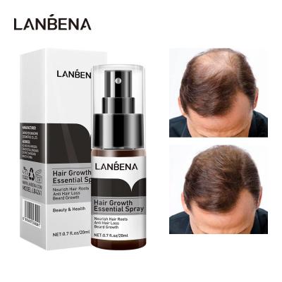 Chine L'essence rapide de croissance de cheveux de LANBENA pulvérisent empêcher la calvitie consolidant l'anti perte des cheveux nourrissent la réparation de cheveux de racines à vendre