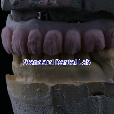 Chine Porcelaine tout sur quatre Pont de zirconium Haut esthétique Pont d'implant dentaire à vendre