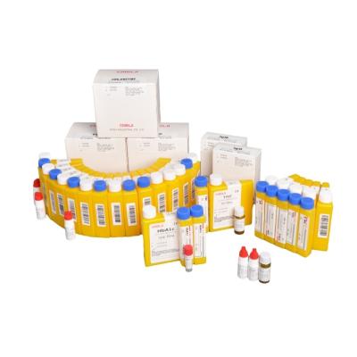 China CNAS Clinical Diagnostic Reagents Chemistry For Renal Clinical Analyzer for sale