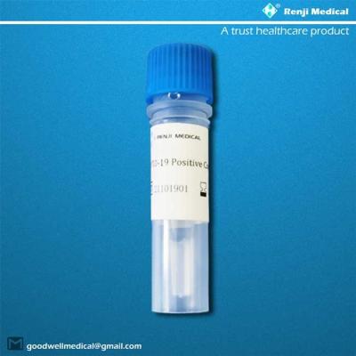 China COVID-19 Novel Coronavirus Test Kit high capacity testing MA YBTC approval for sale