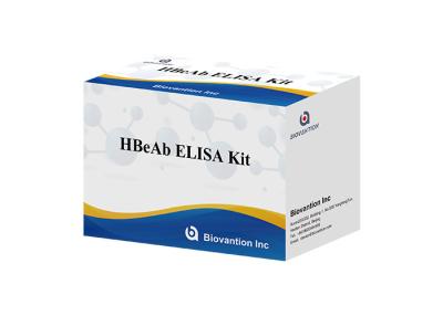 Cina Corredo della prova dei pc COVID-19 del siero 96 60 minuti HBeAb umano Elisa Kit in vendita