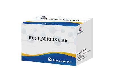 China ISO13485 HBc IgM Test Kit Hepatitis B Core Antibody Igm Test for sale