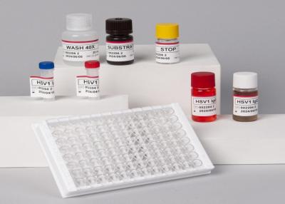 China High Precision  For Laboratory Or Hospital High Precision RUO Human TNF-α Elisa Test Kit à venda
